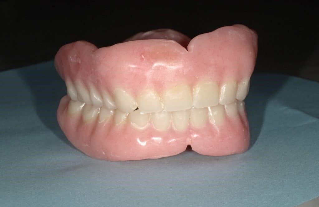 Partial Dentures Before And After Avon Lake OH 44012
